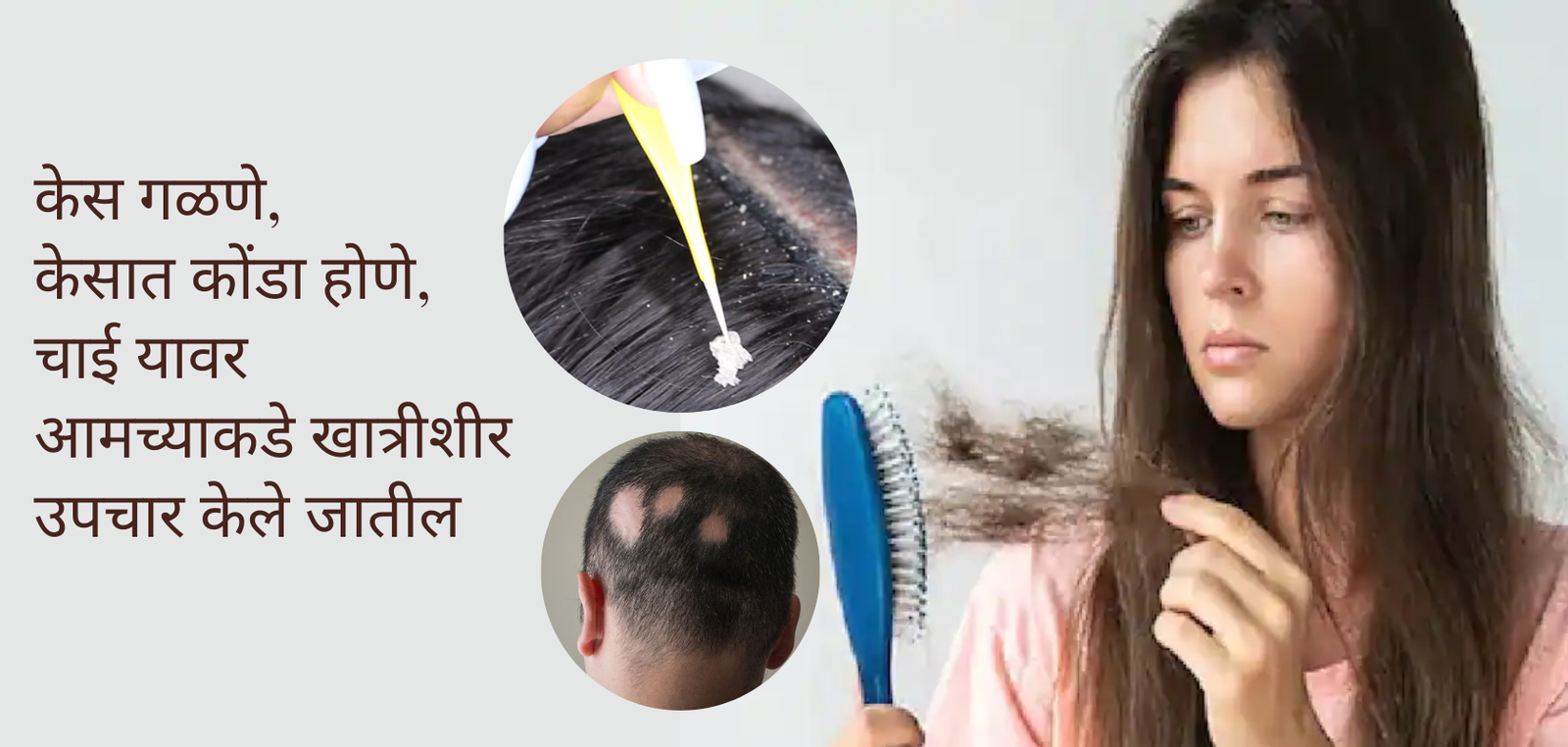 केसांचे आजार