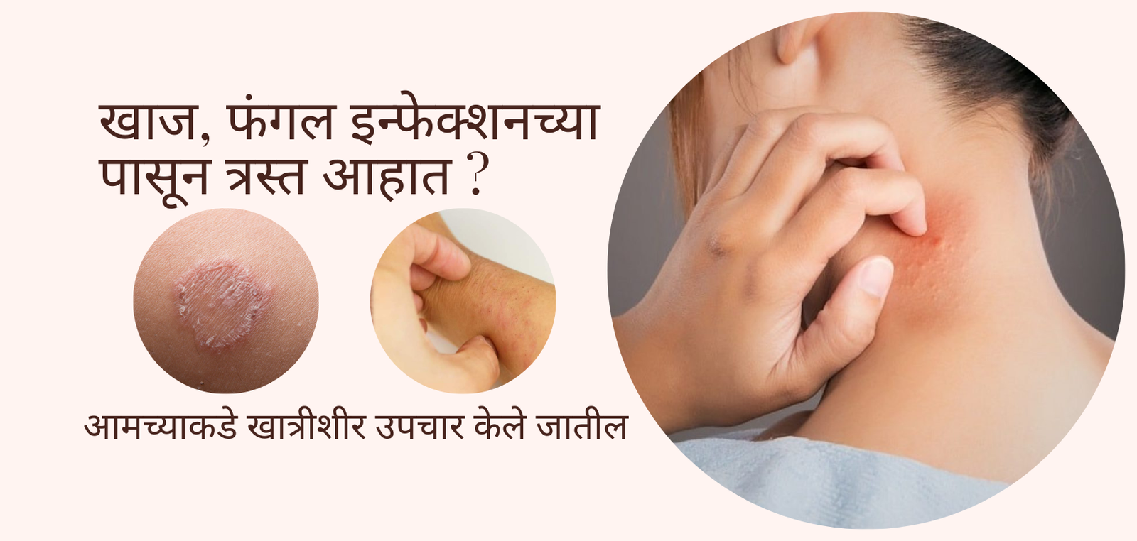 त्वचारोग