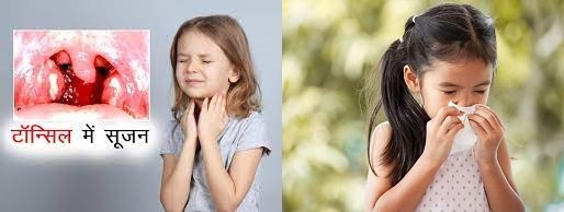 लहान मुलांचे आजार