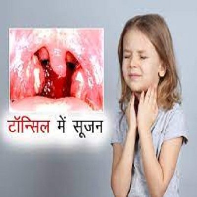 लहान मुलांचे आजार